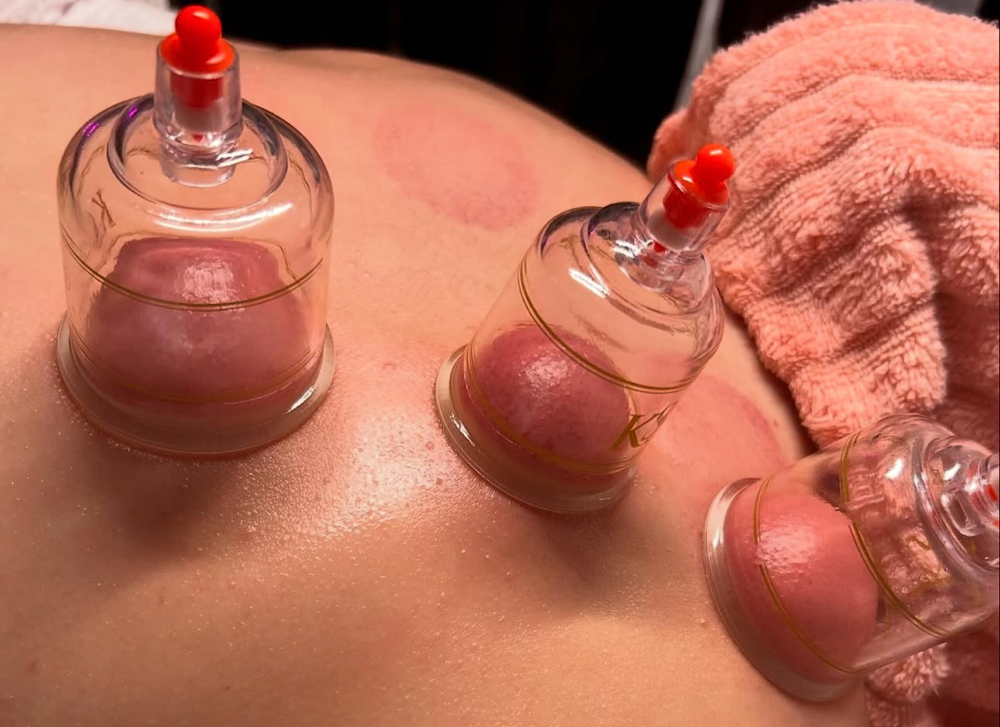 Back Cupping Massage