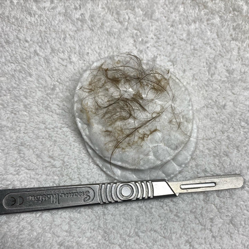Dermaplane *Add On*