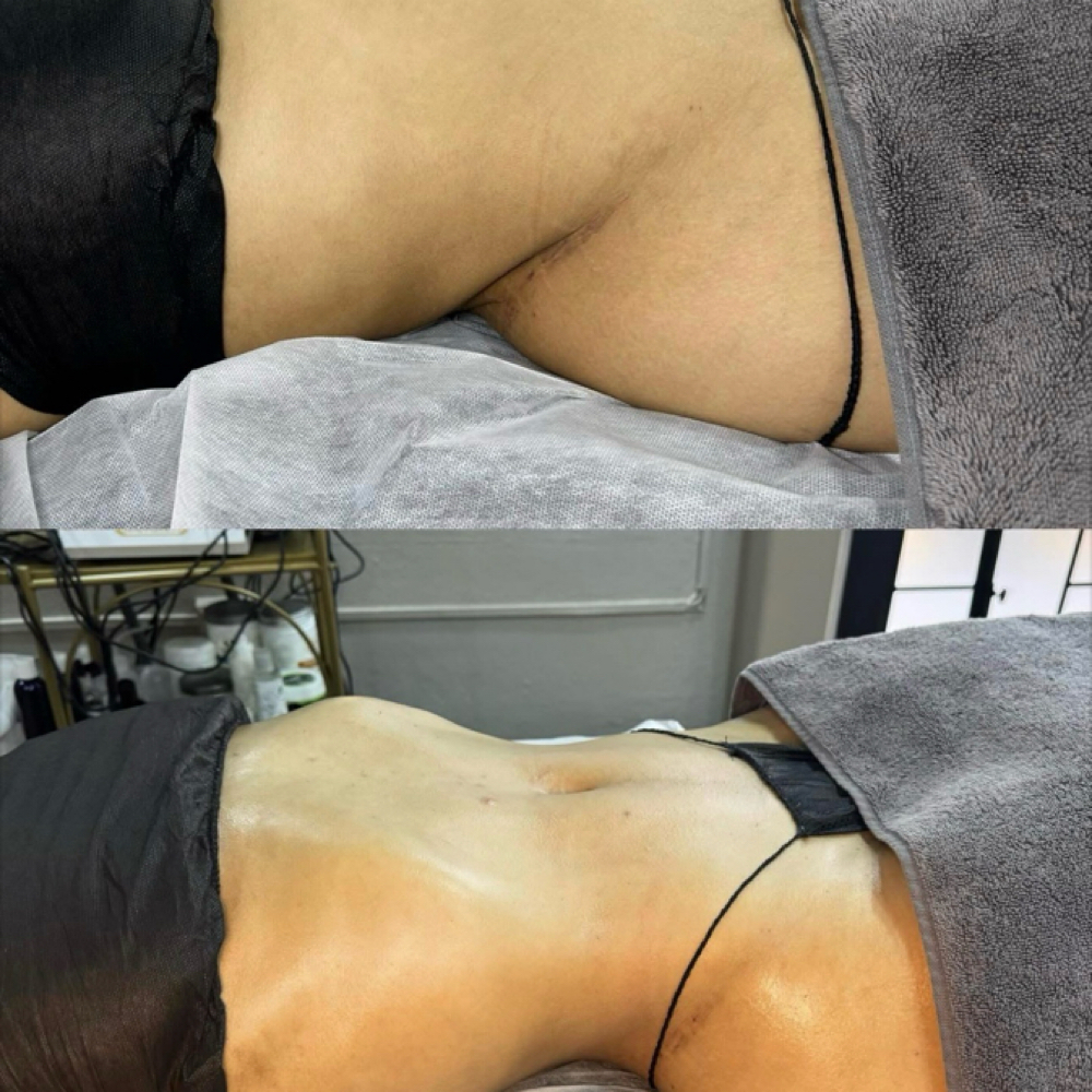 💆 Sculpt & Tone Body Contourin at Bella Esthetic and Spa LLC in Cleveland, OH