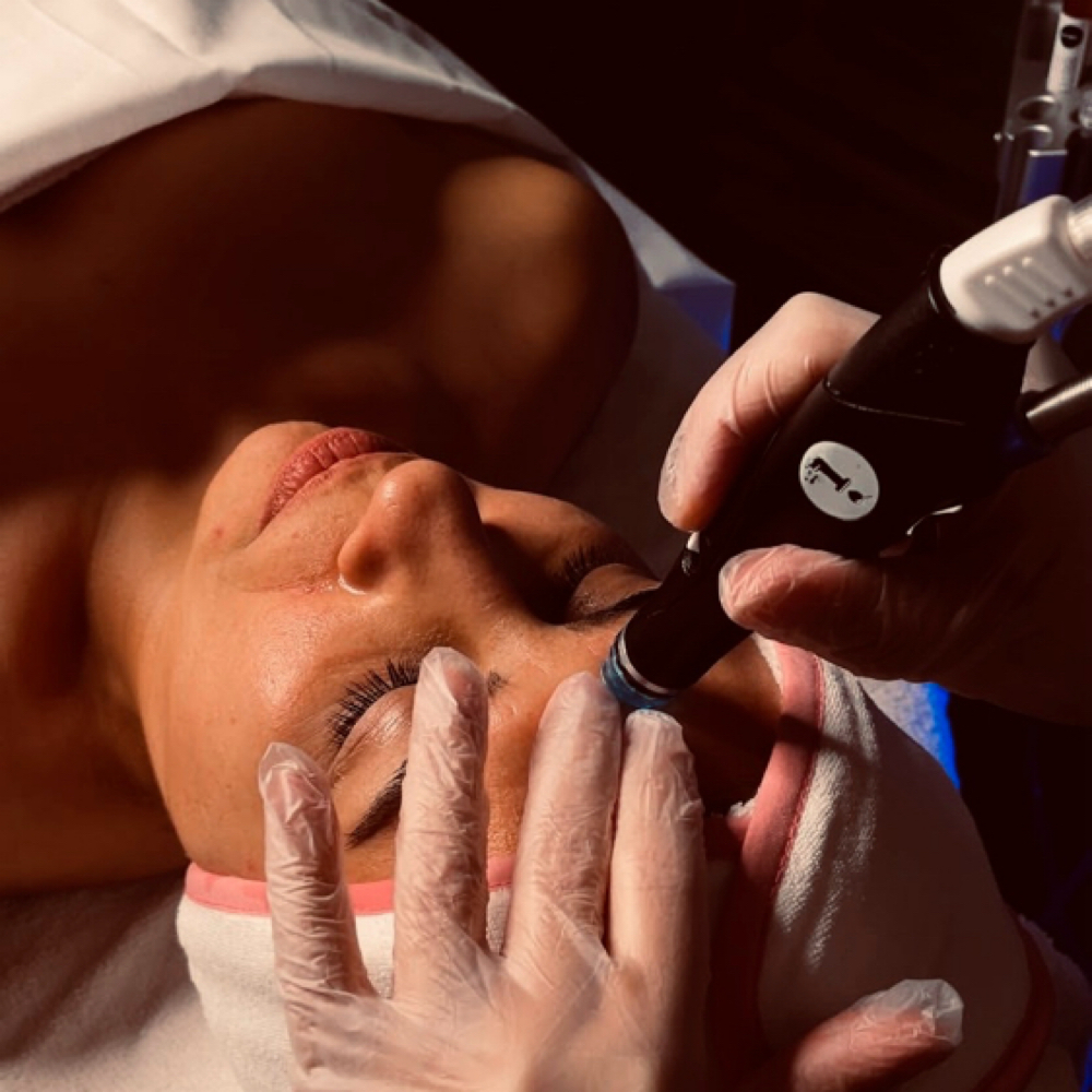 HYDRODERMABRASION at Wild West Skin Lounge in Chattanooga, TN