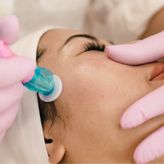 MicroNeedling Facial at Quiet Beauty Spa in Newport Beach, CA