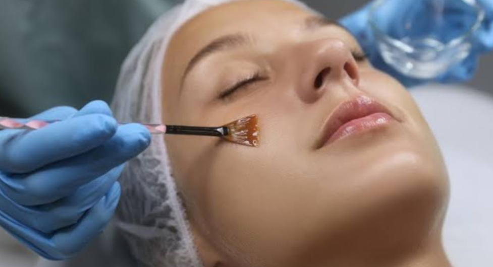 Expess Resufacing Treatment