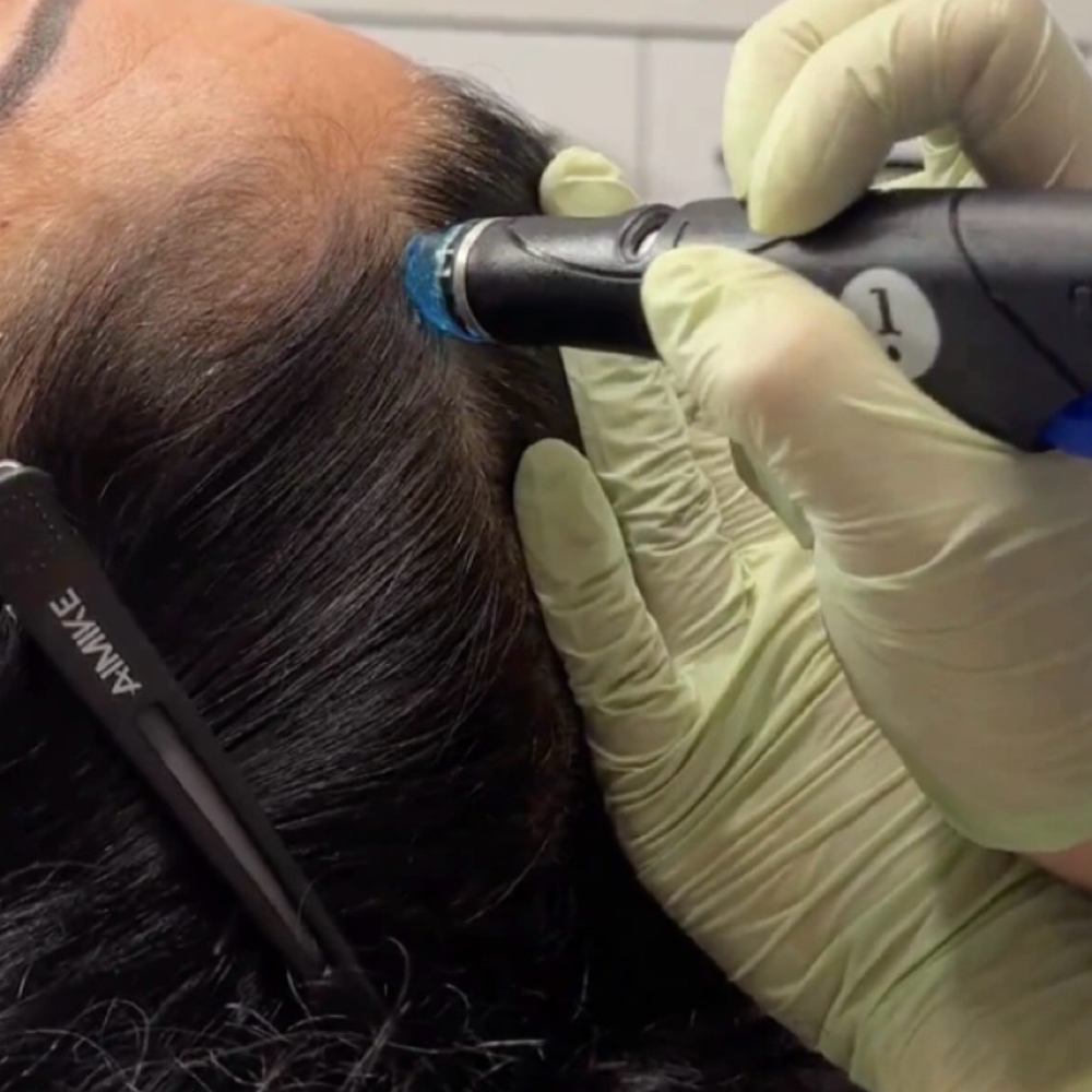 Head Spa (Scalp Dermabrasion) at Rejuva Glow Beauty in Bethesda, MD