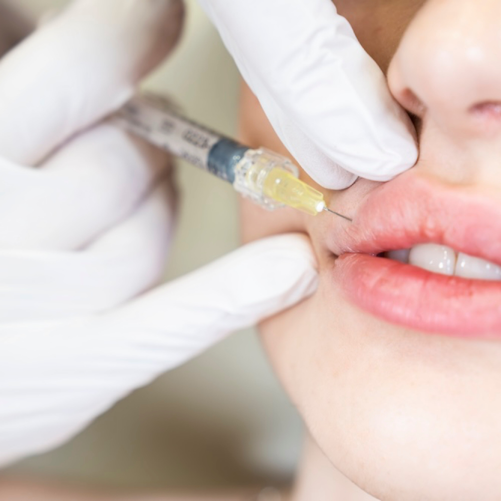 Lip Flip at Empower Aesthetics in Canyon Lake, TX