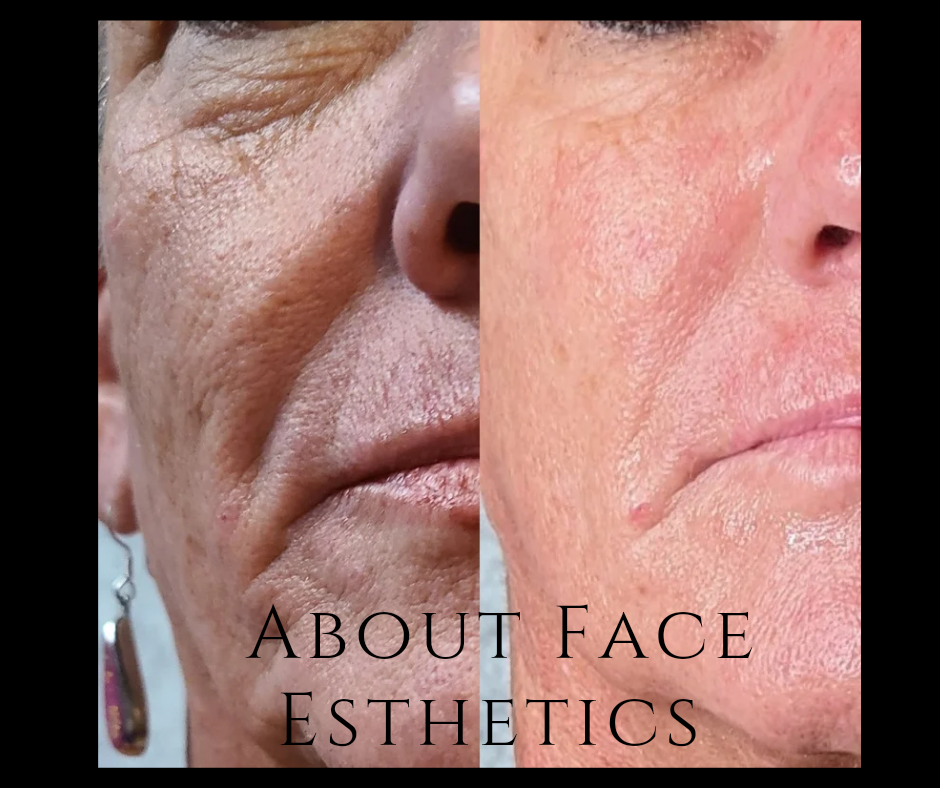 Renewal Facial For Menopausal Skin