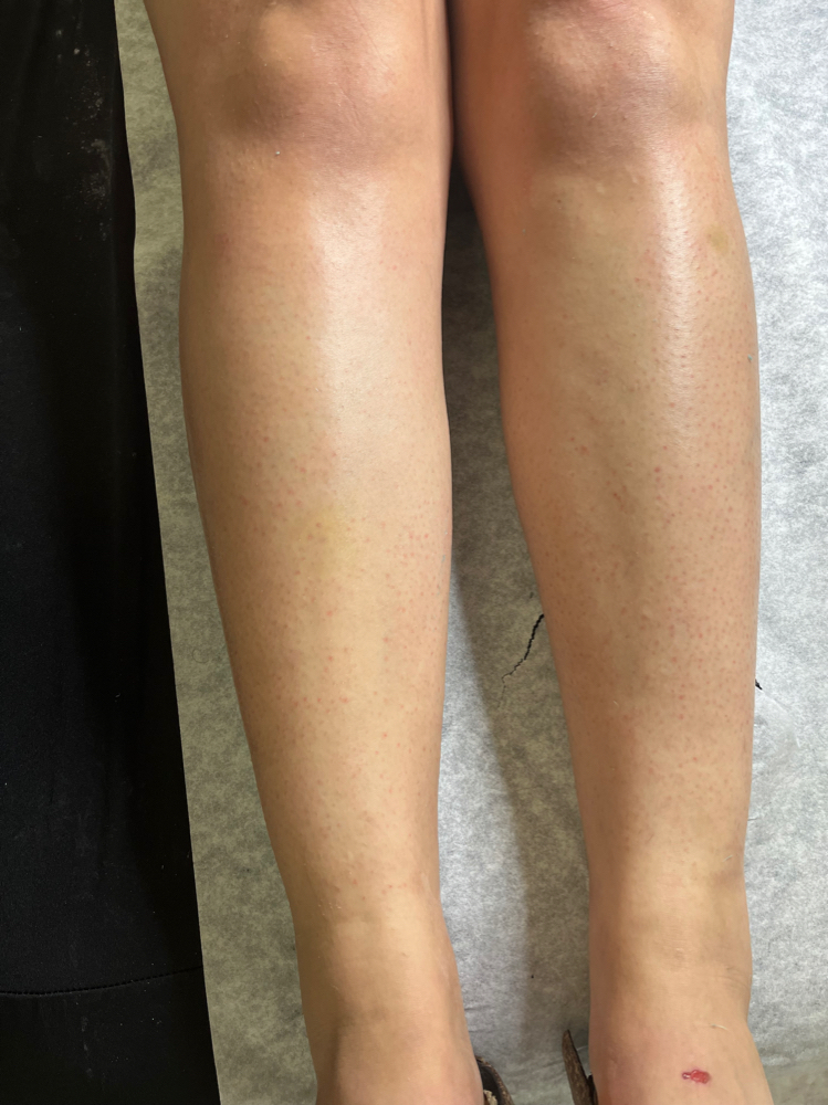 Leg (Half)