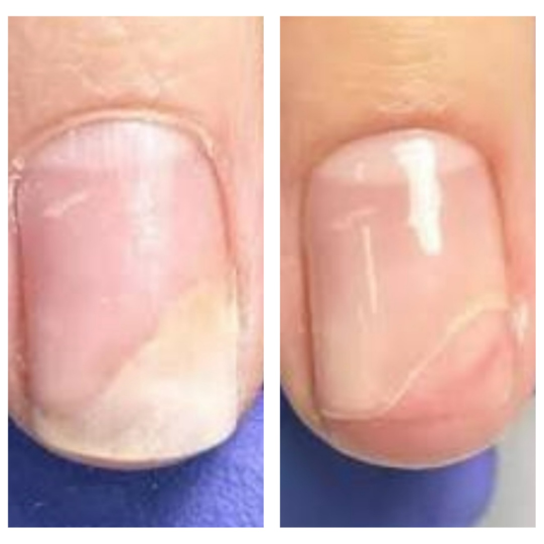 Nail Repair (Per Nail)