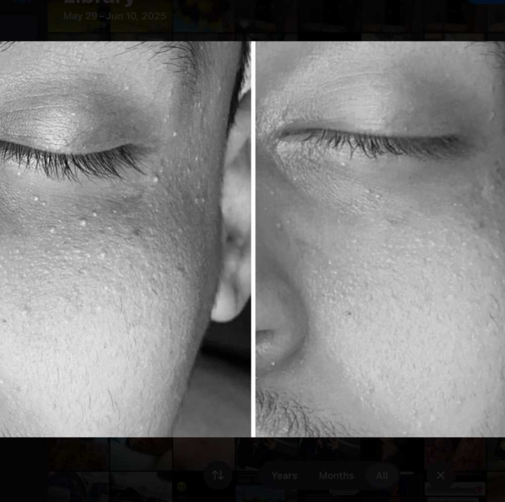 Purity Facial at Skin by Giselle in Commerce City, CO