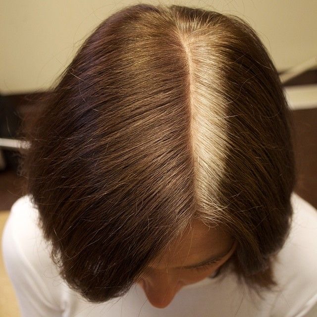 Root Touch-Up