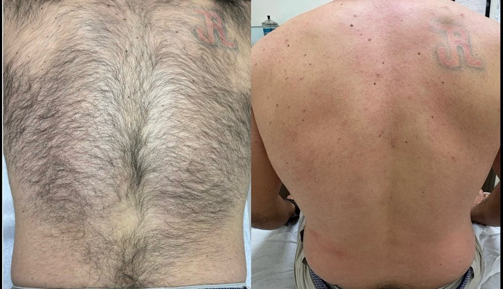 Back (Full) Wax
