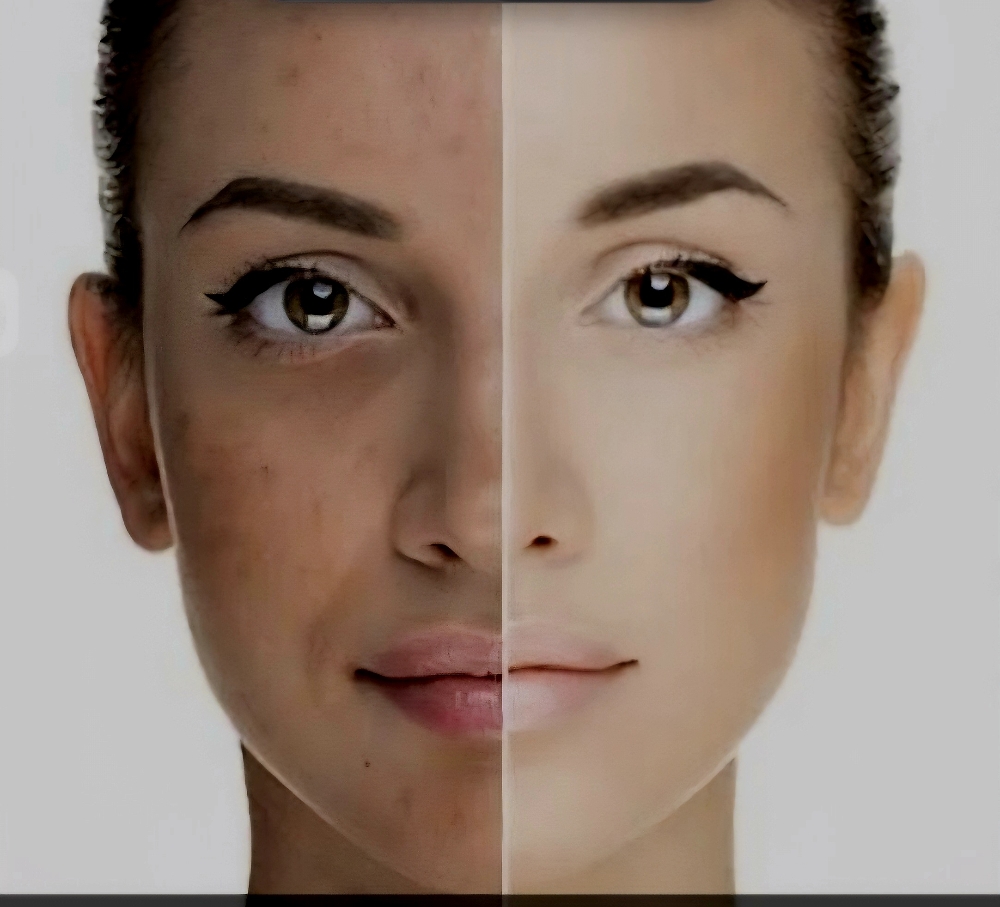 Glow Peel + Free Dermaplaning