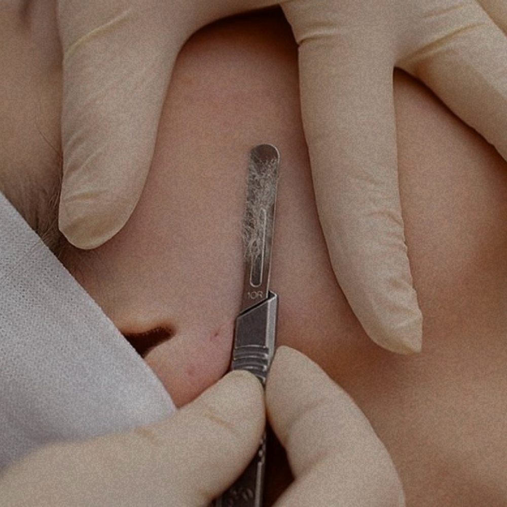 Dermaplaning for Members at Skin Care by Kayla in Martinez, GA