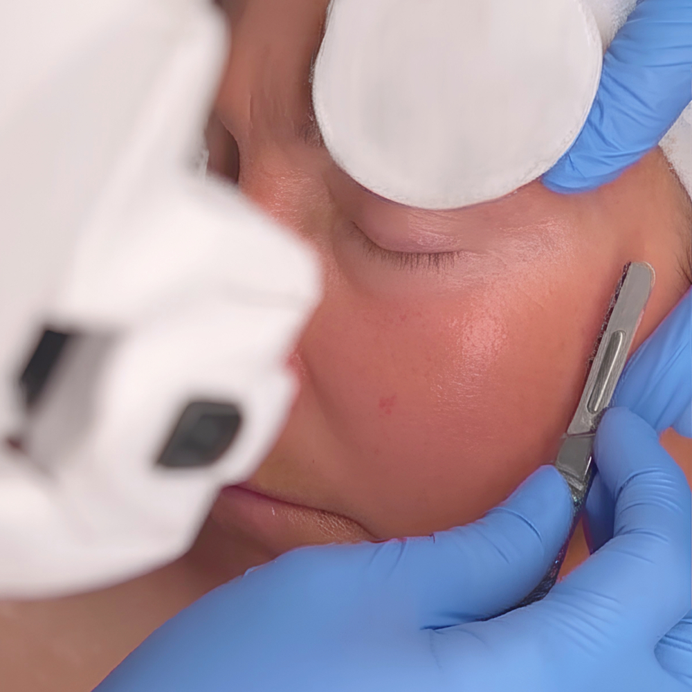 Dermaplaning for Members at Skin Care by Kayla in Martinez, GA