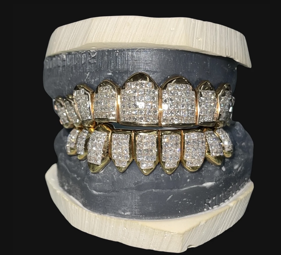 Diamond Grillz