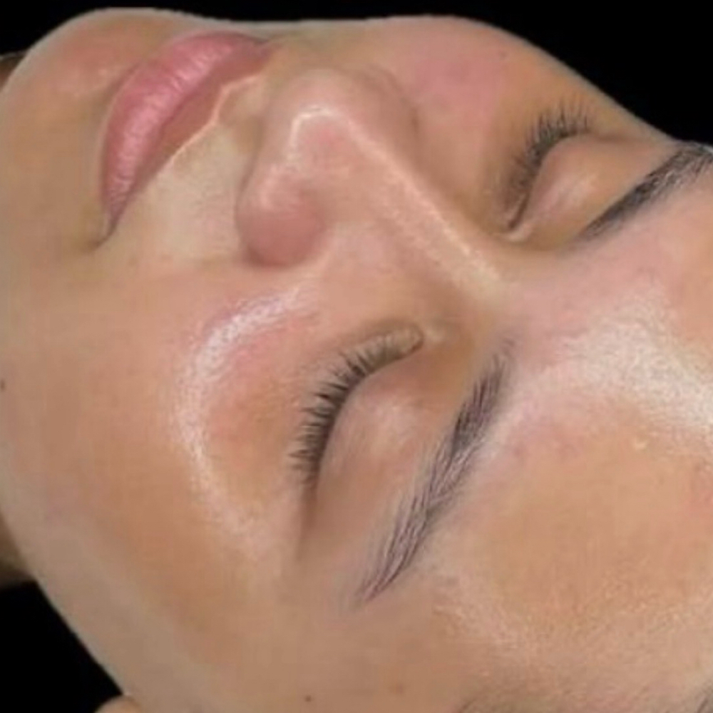 MaryLous Oxygen Glow Facial at Marylous Electrology in Somerset, MA