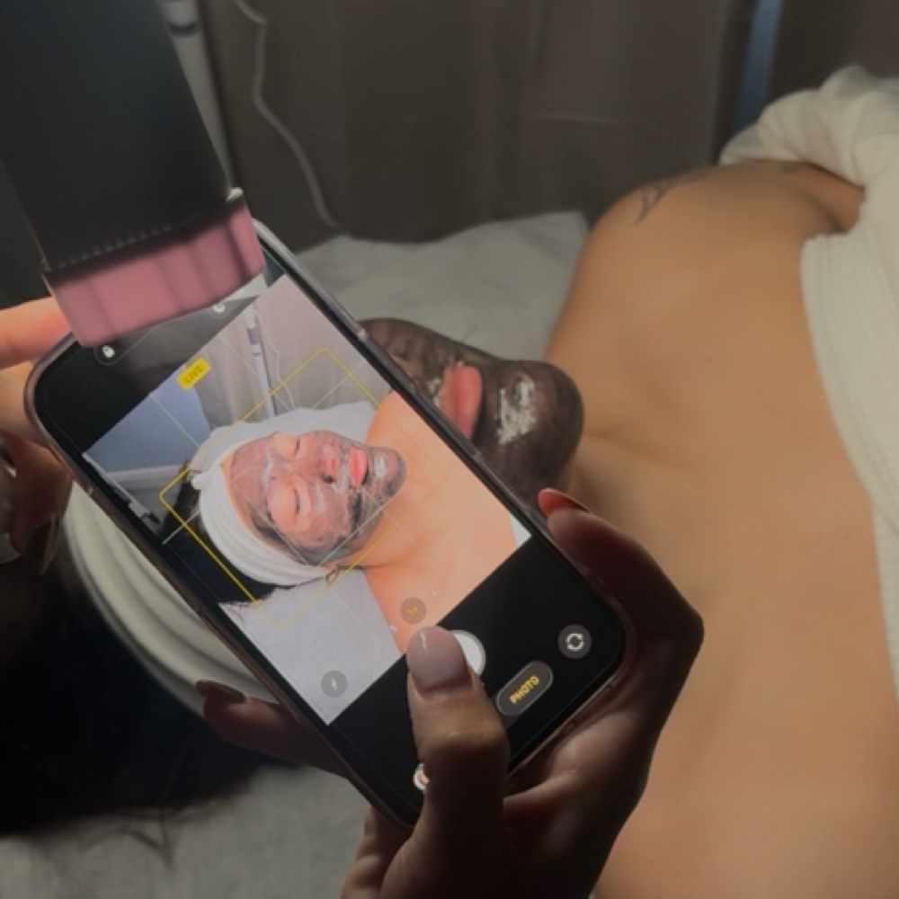 Dermaplaning Facial at Beauty By Kay