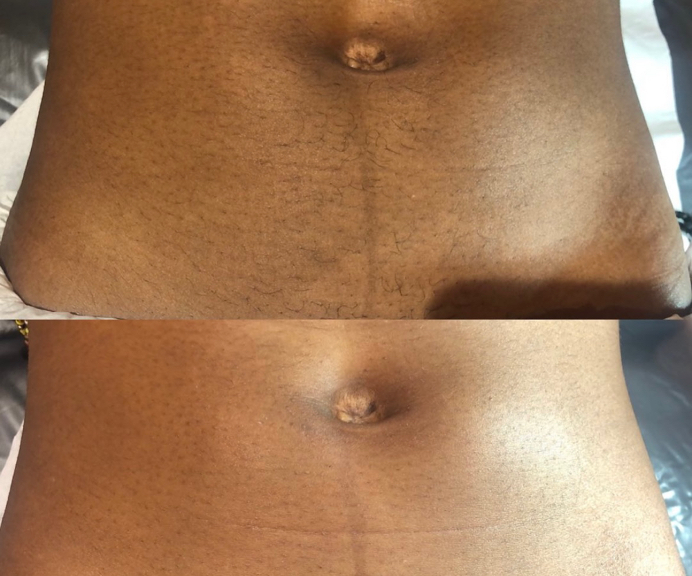 Happy Trail (Stomach)