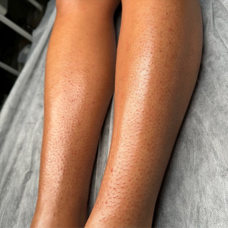Lower Leg Wax at Skin by Li LLC in Manchester, CT
