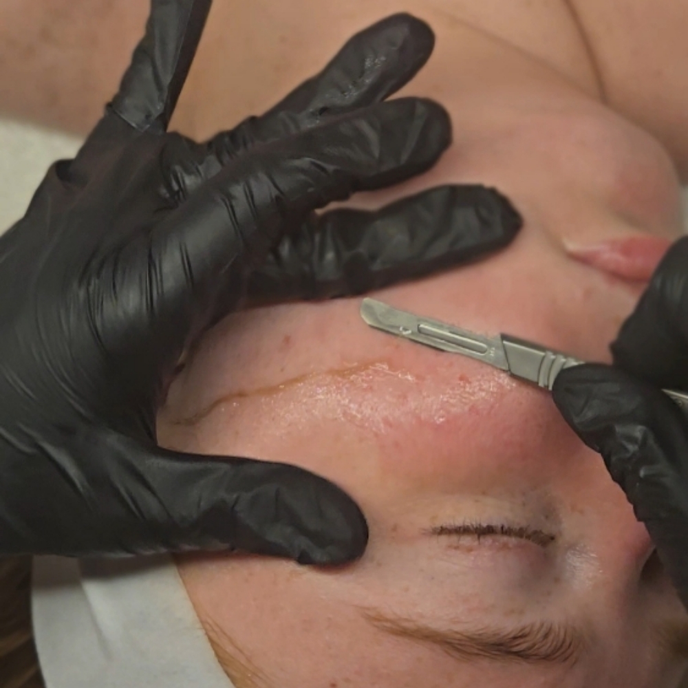 Beauty Refining Facial at CareBeautyDerm in Smithtown, NY