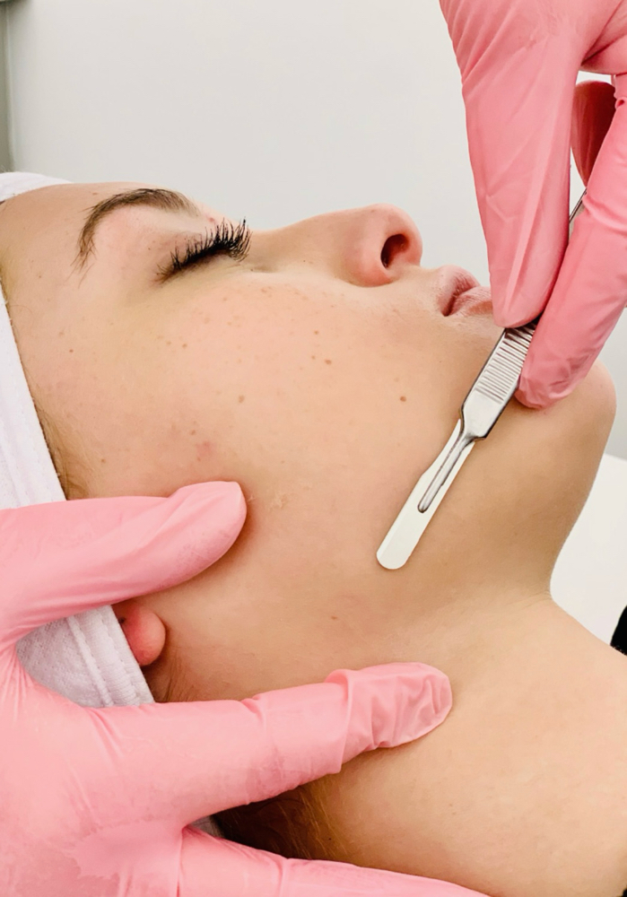 Dermaplane Facial