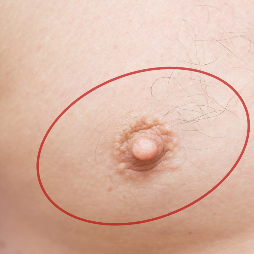 Nipples at Bareline Aesthetics in Brea, CA