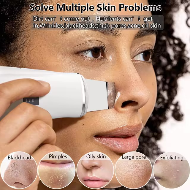 Black Head Nose Extractions ONLY