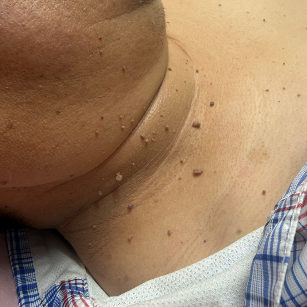 Verrugas En El Cuello at 🎀Pink Diamond Beauty studio🎀 in Irving, TX