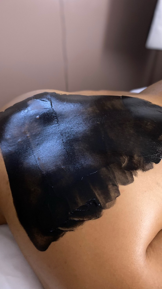 Back Facial at Beauty & Esthetics by Sol Luna in Inglewood, CA