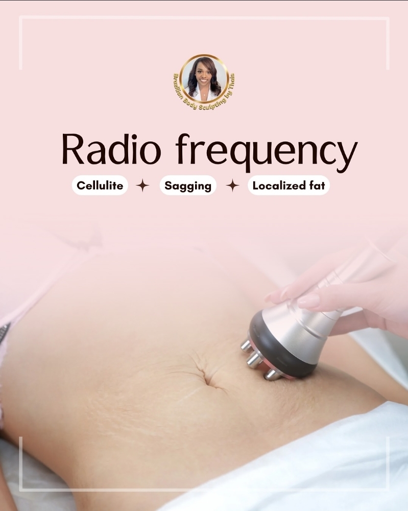 RF Skin Tightening Stomach