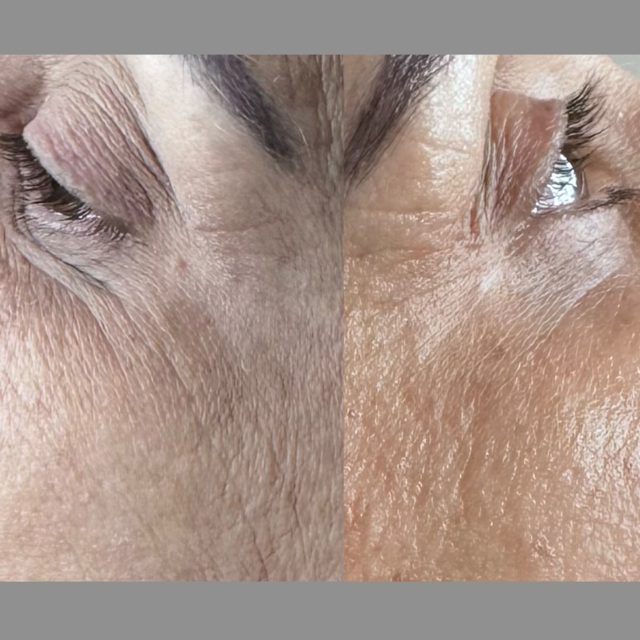 5D Hydrating Facial at Eula Skin in Dallas, TX