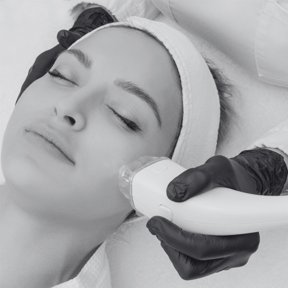 Laser Hair Removal - Full Face at Kietre Wellness & Aesthetics in North Las Vegas, NV