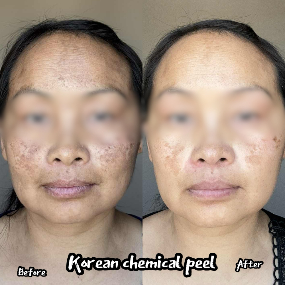 Green Sea Peel at Heavenbeautebar in Sacramento, CA