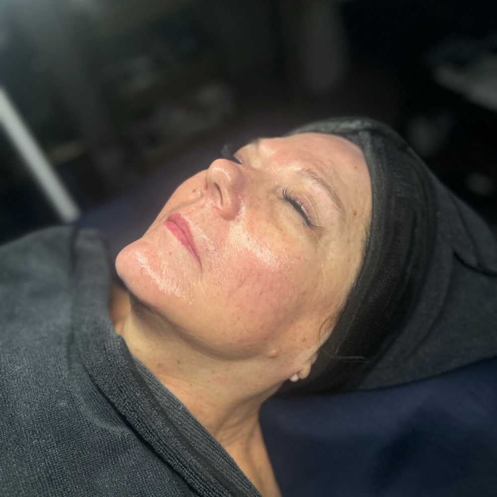 Facial Services at Blu 10 Aesthetics in Chattanooga, TN