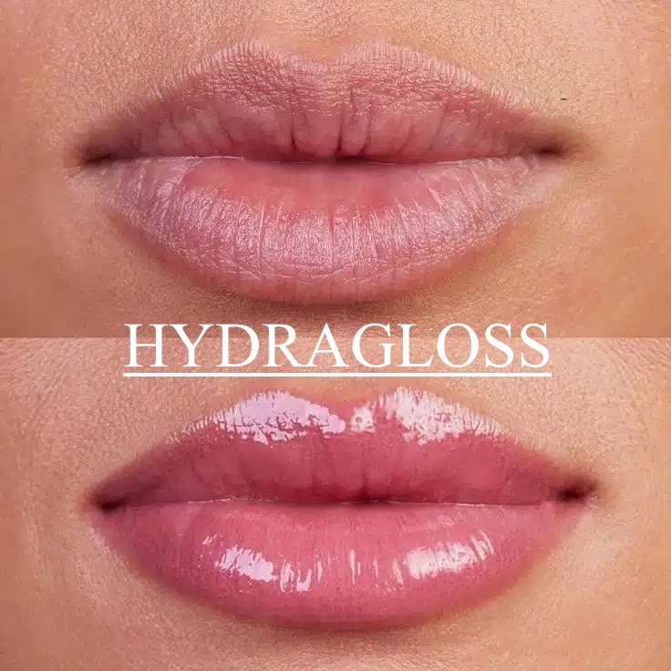 HYDRA GLOSS LIPS 👄