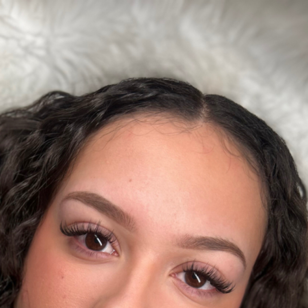 Hybrid Fill at Doliveira Aesthetics in Cumberland, IN