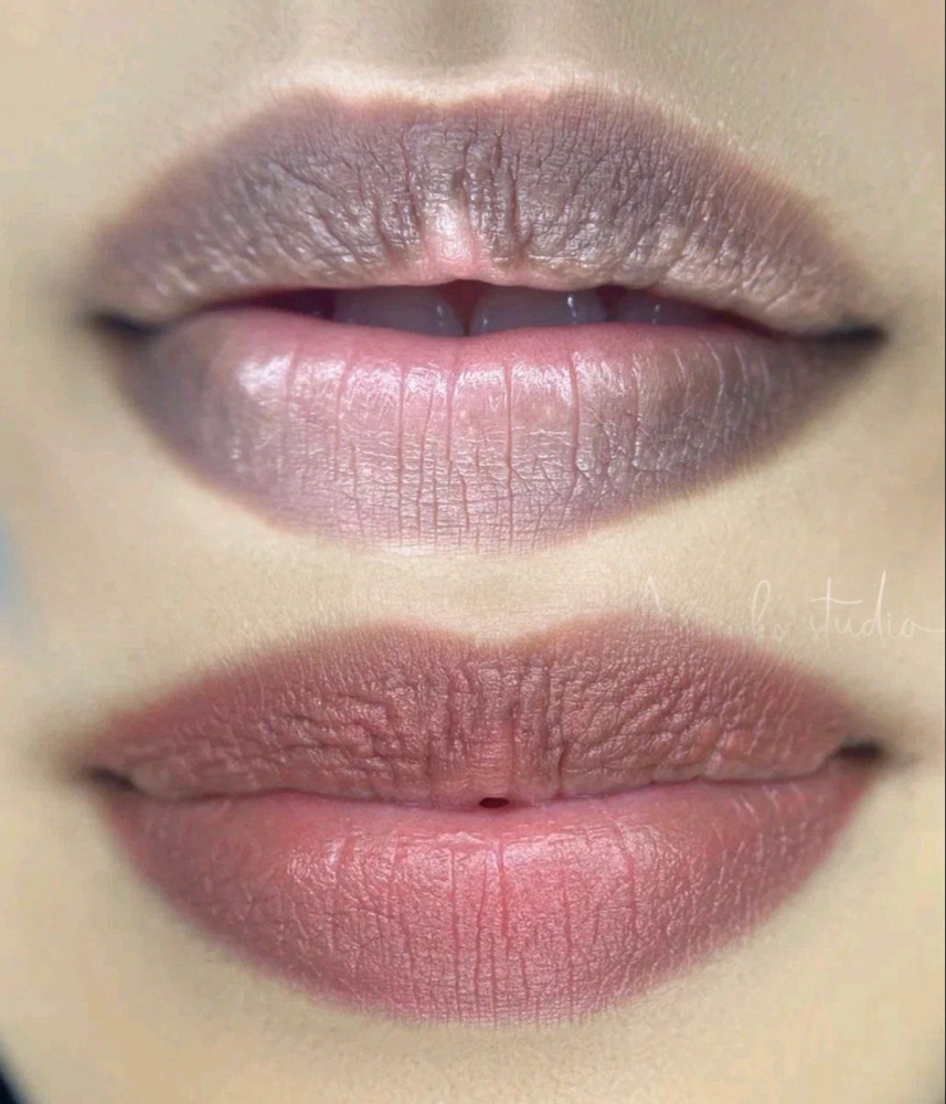 Lip Neutrilization