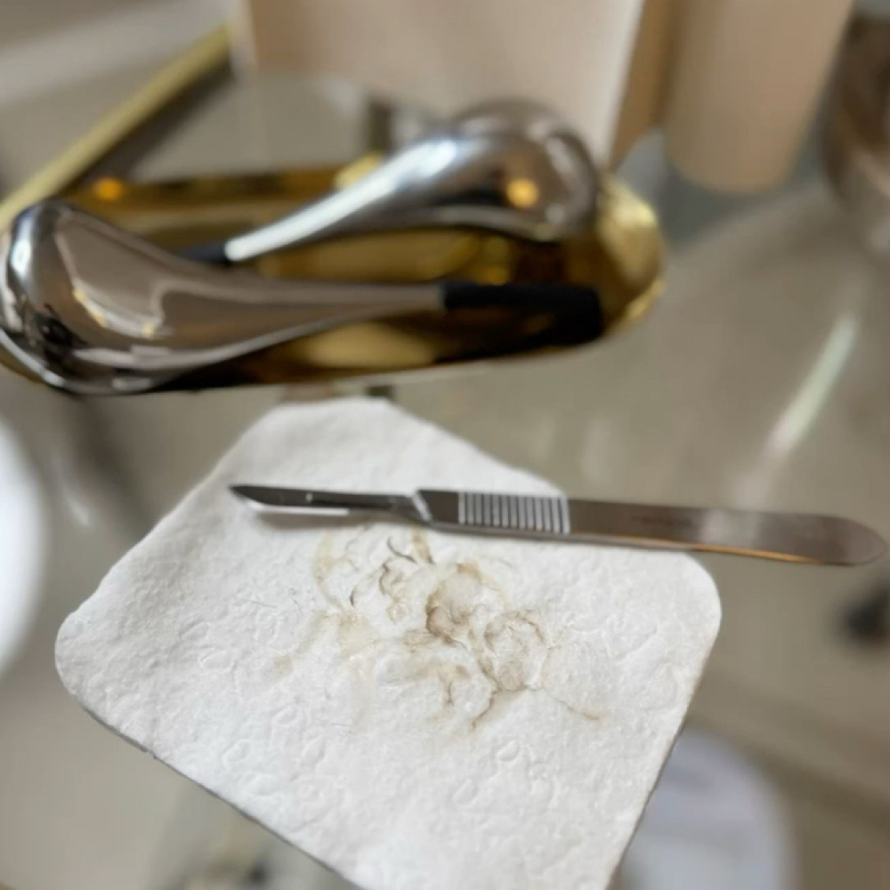 Dermaplaning ADD-ON at AM Aesthetics in Astoria, NY