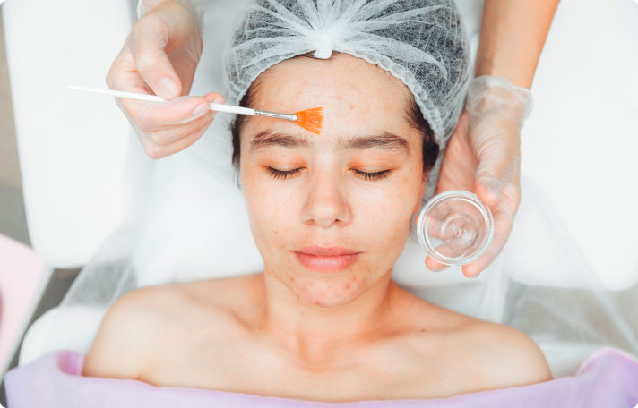 Immortal Clear Reset Peel at IMMORTALIZED BEAUTY BY ANGIE in Riverbank, CA