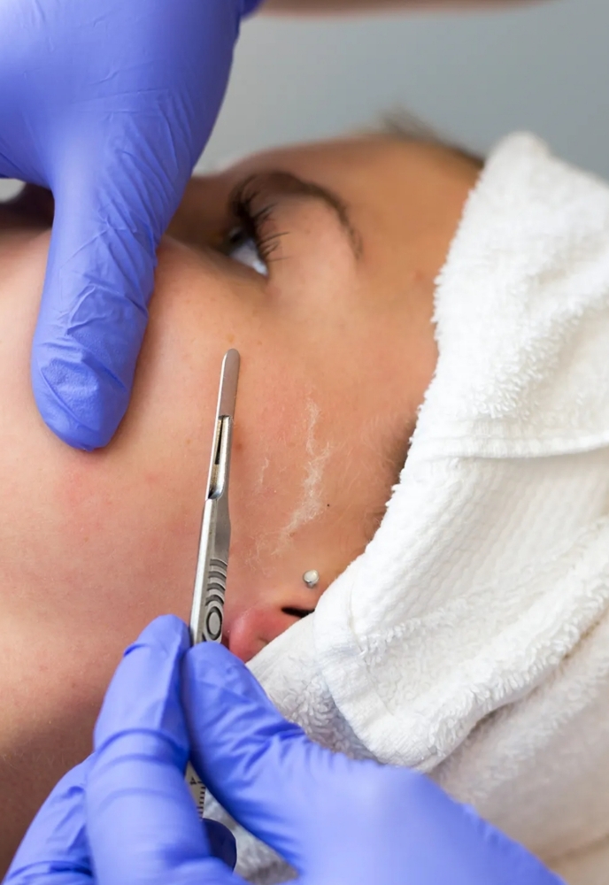 FULL facial With Demaplaning