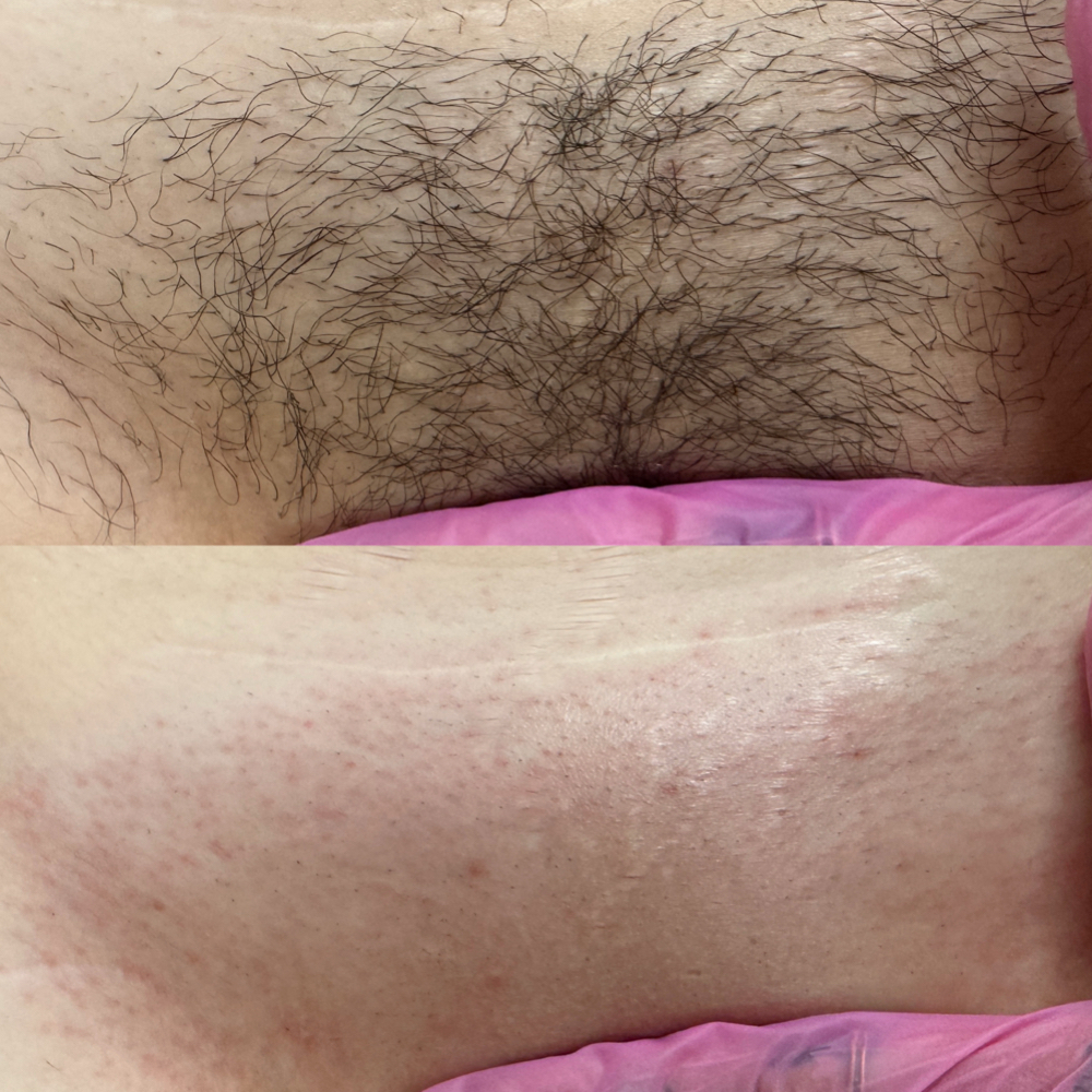Brazilian Wax at Volume One Beauty in Lewiston, ME
