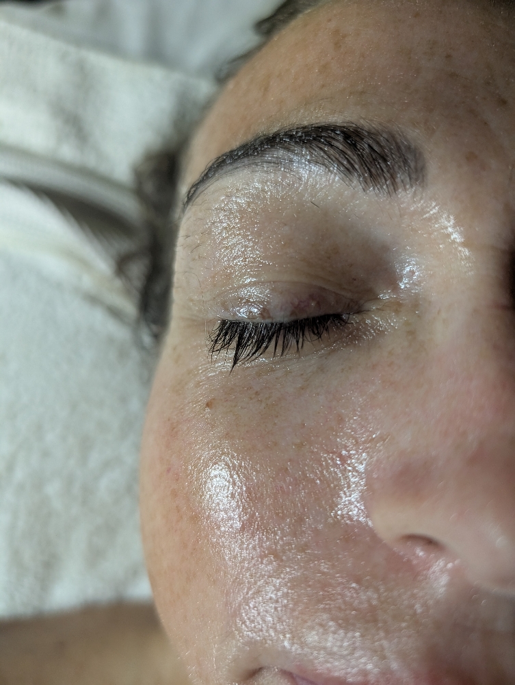 ✨ EPIFUSHION FACIAL ✨