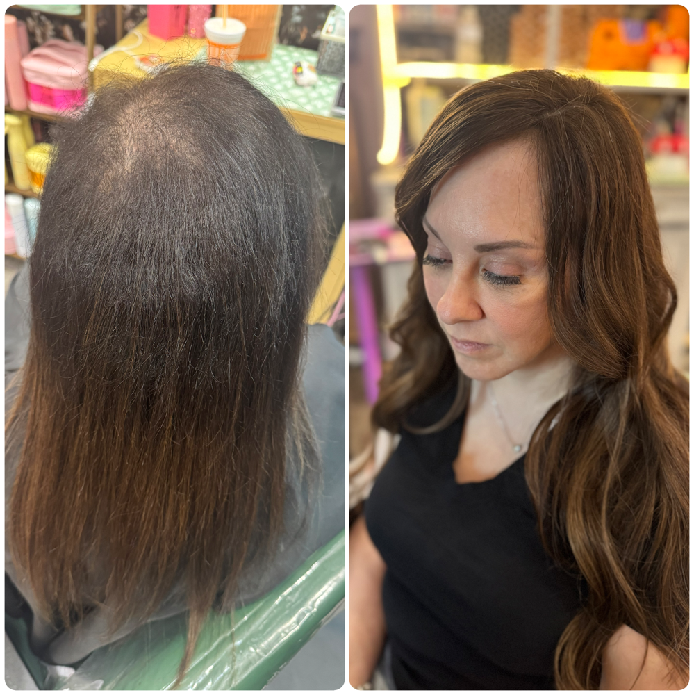 HAIR LOSS CONSULTATION