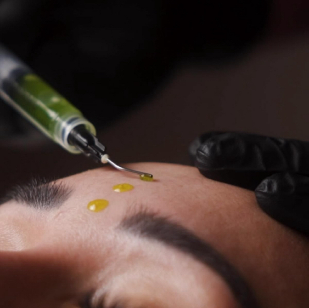 Glow Peel Treatment at GIRONDA MIAMI in MIAMI, FL