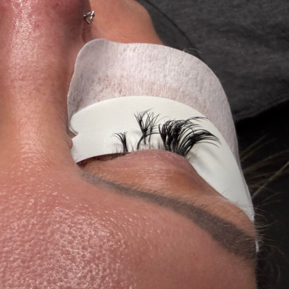 Removal at jaesthetics in Baytown, TX