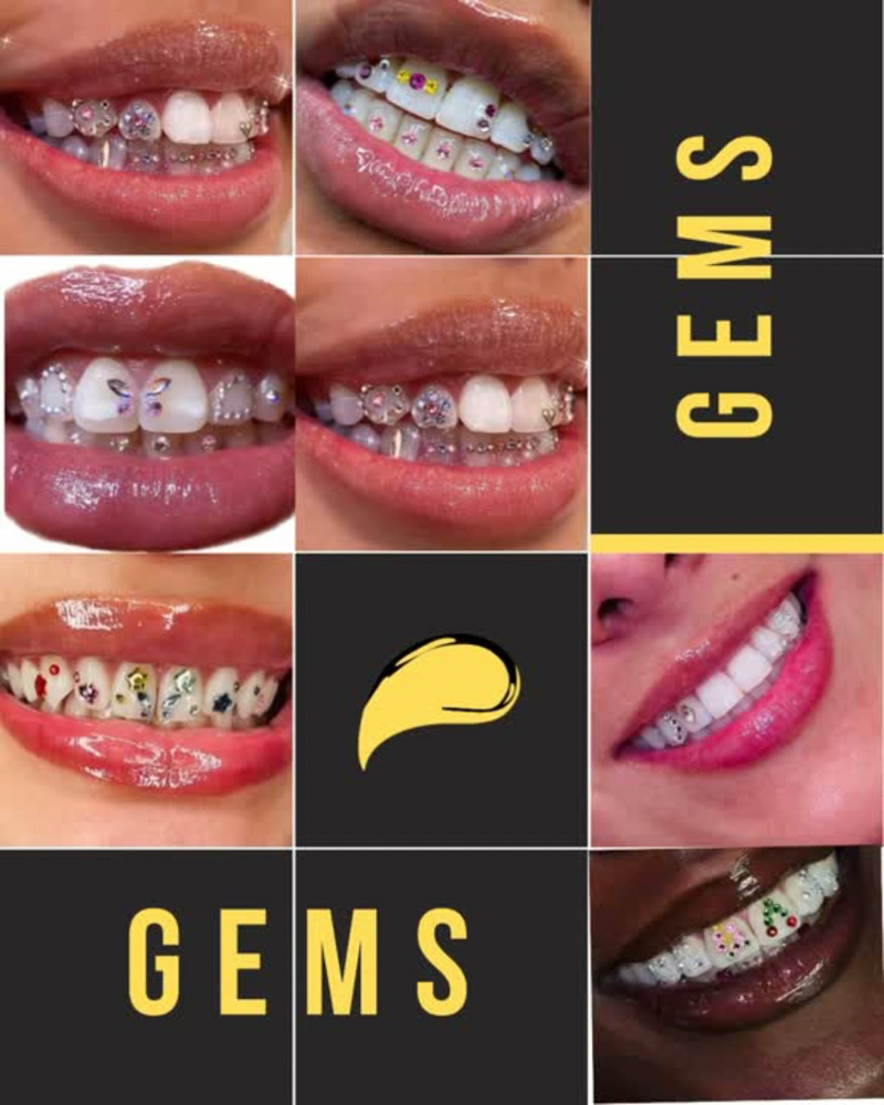 Teeth Gems
