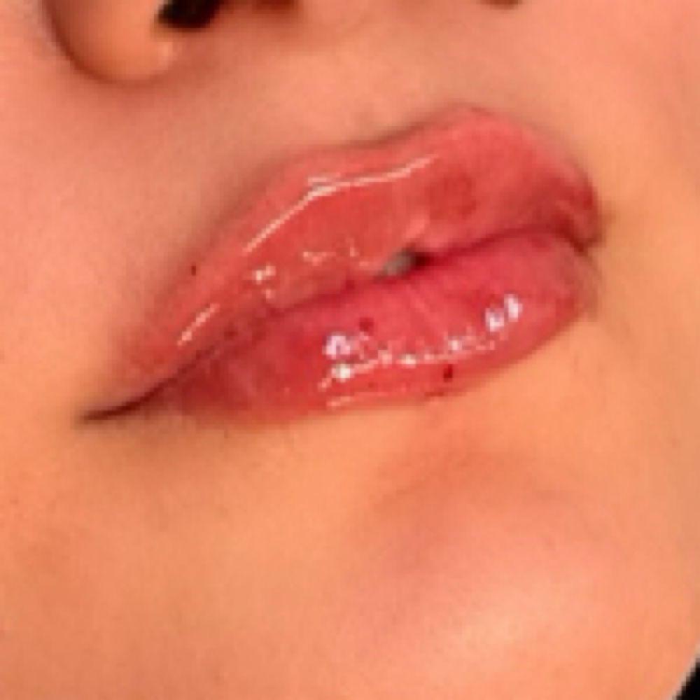 Lip Filler 0.5 ML at The Inkjectables Lab in El Paso, TX