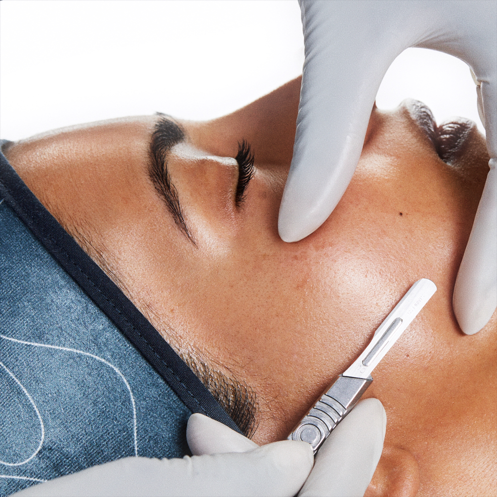 Dermaplane Facial