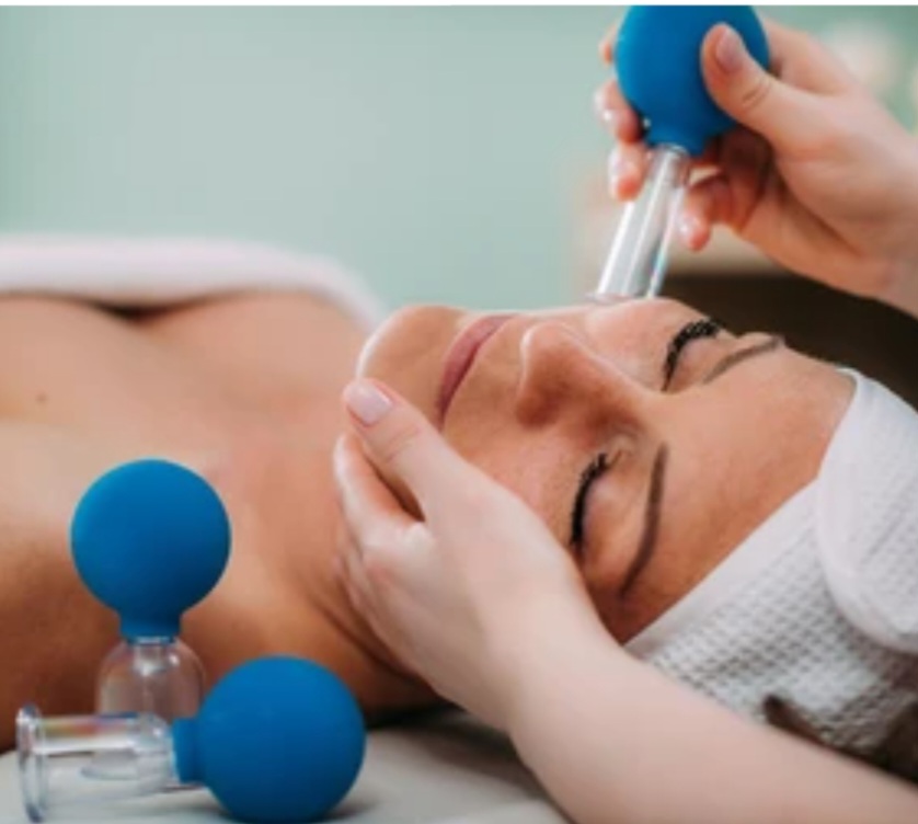 Cupping Therapy