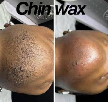 Chin Wax