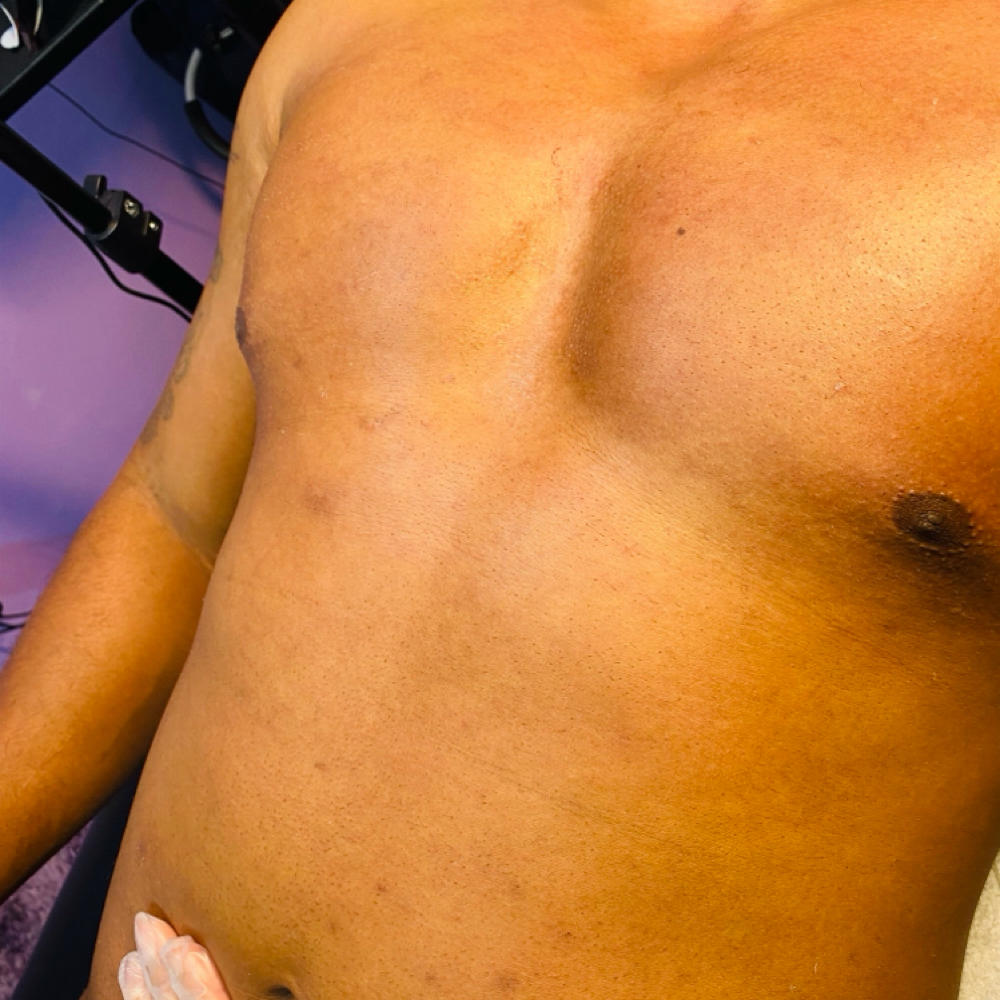 Chest at Baddies Beauty & Wax in Raleigh, NC